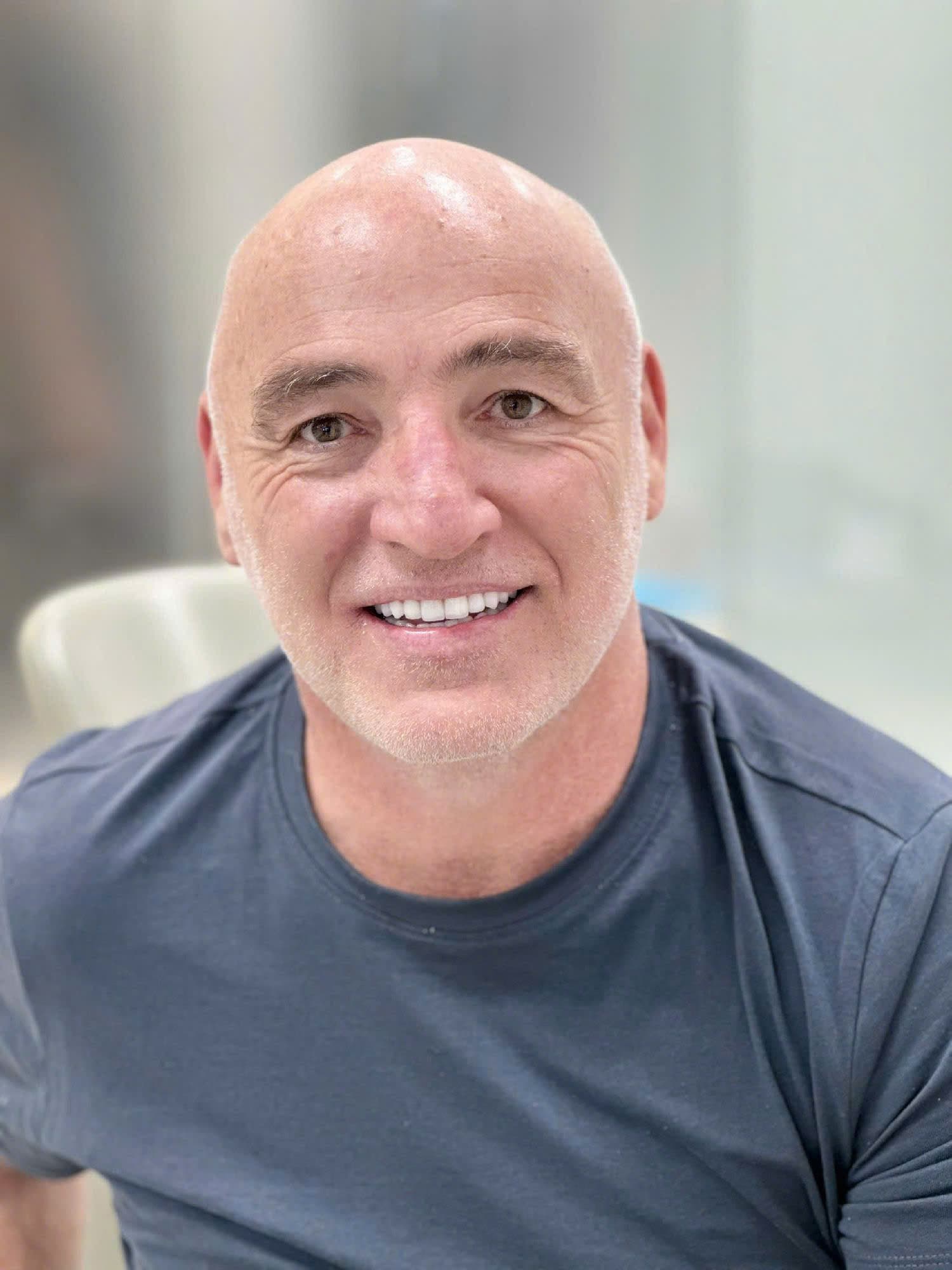 International dental patient smiling after treatment