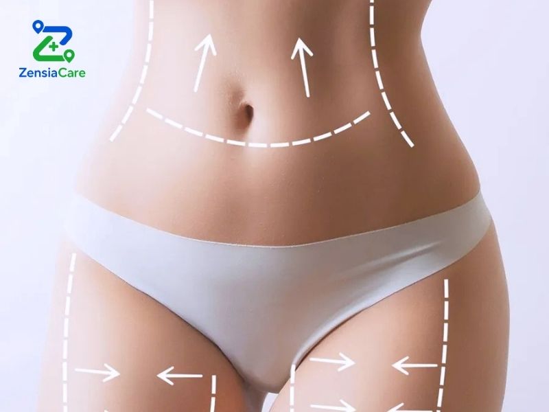 Body Contouring with Liposuction